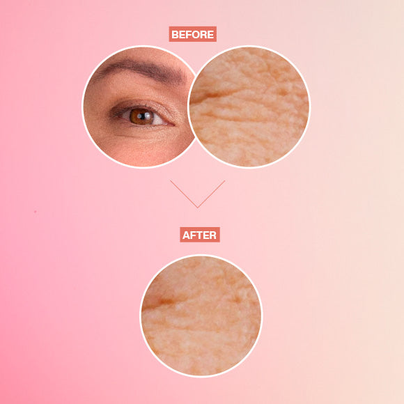 CHRONOS - Wrinkle Reducing Eye Balm - 15G