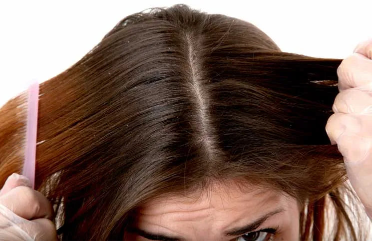 LUMINA- ANTI-DANDRUFF HAIR TONER - 100ML